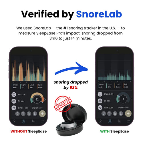 SleepEase Pro — Throat Muscle Strengthening — Eliminates Snoring & Sleep Apnea