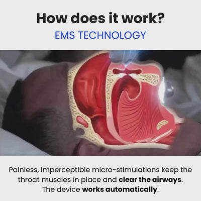 SleepEase Pro — Throat Muscle Strengthening — Eliminates Snoring & Sleep Apnea